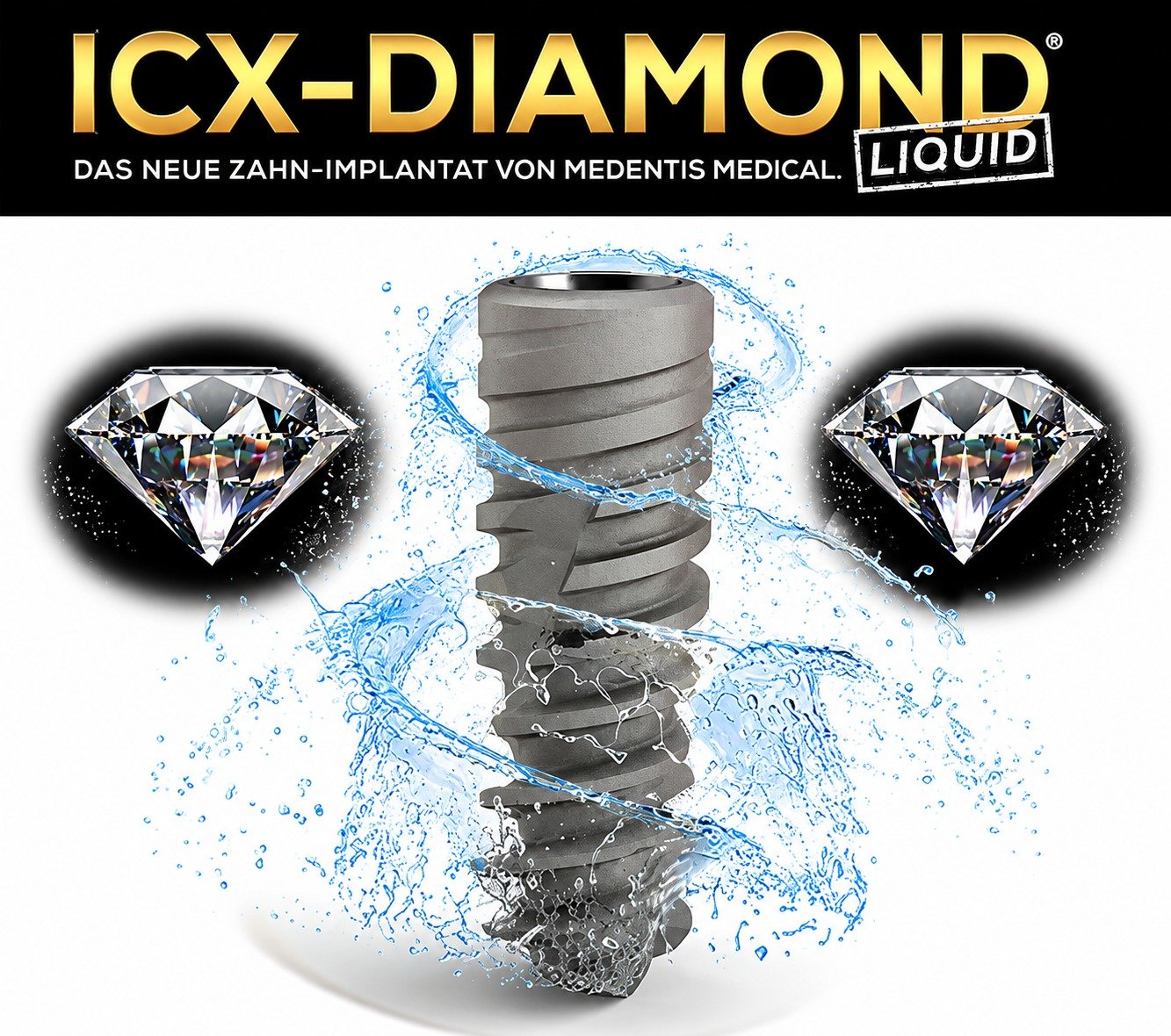 ICX-Diamond