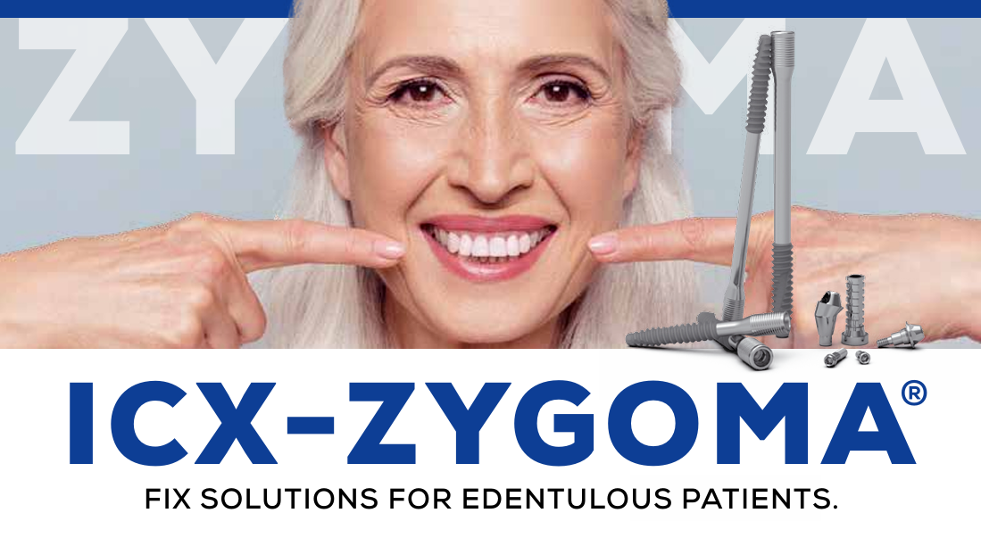 icx zygoma